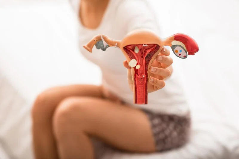 SIBO a endometrioza — dlaczego te dwie choroby tak często współistnieją?