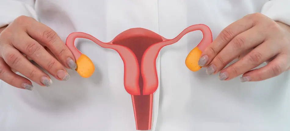 SIBO and PCOS and hormonal disorders in women