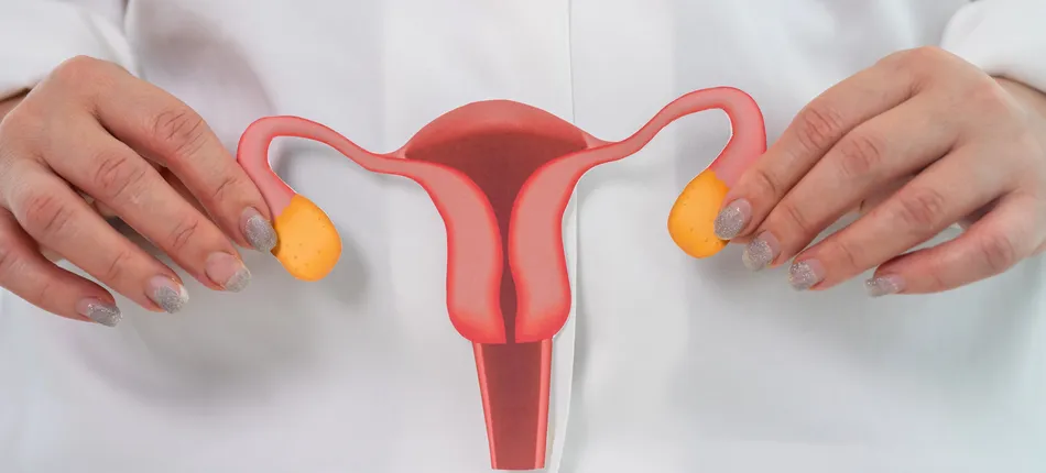 SIBO a PCOS i zaburzenia hormonalne u kobiet